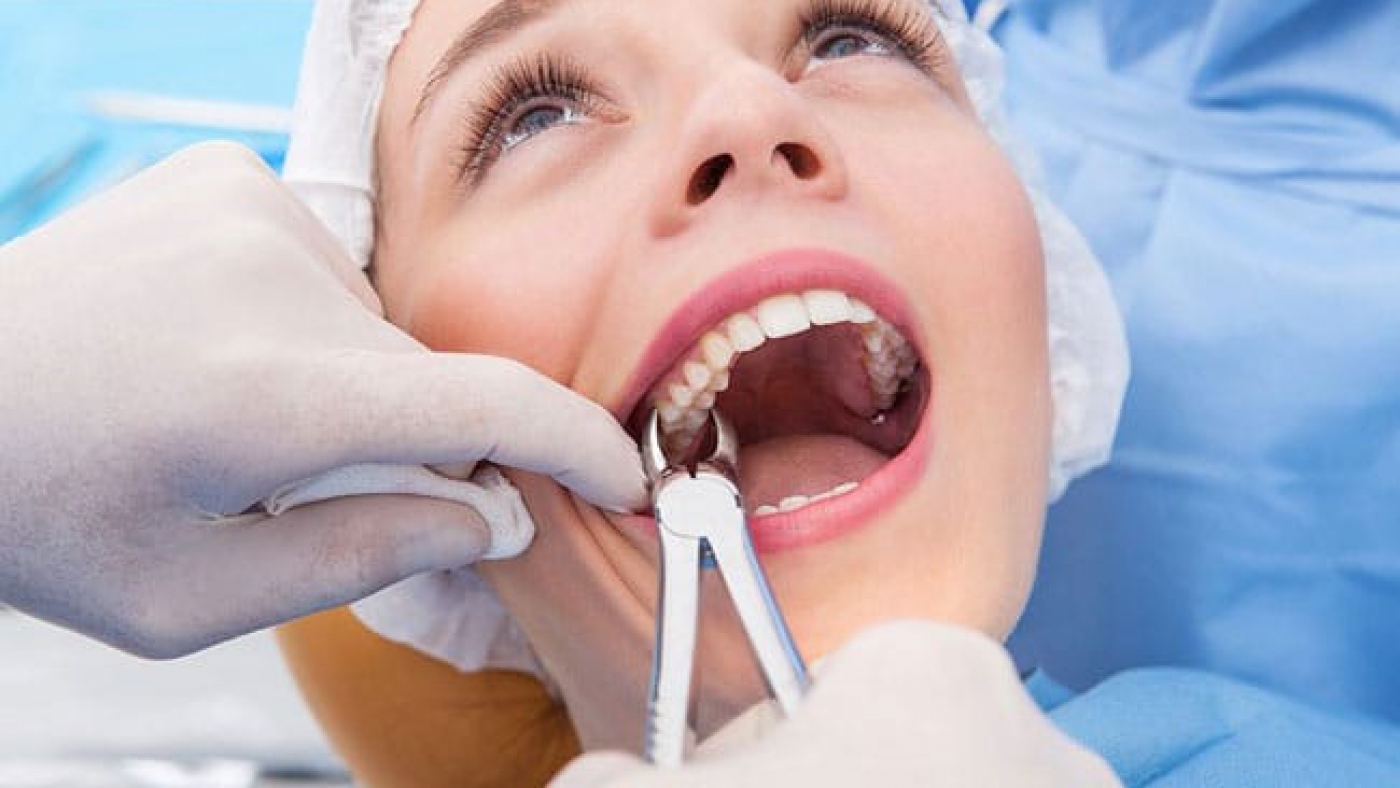 کشیدن-دندان-در-ارتودنسی-برای-باز-شدن-فضا-و-رفع-شلوغی-بین-دندانها