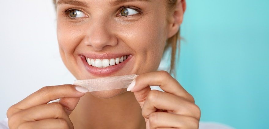 سفید کردن دندان با چسب
